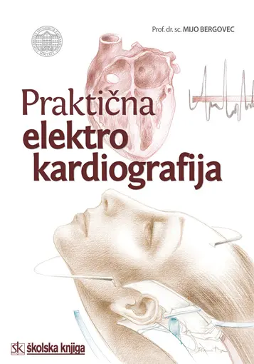 Praktična elektrokardiografija, Bergovec Mijo