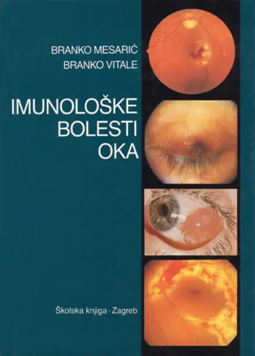 Imunološke bolesti oka, Mesarić Branko, Vitale Branko