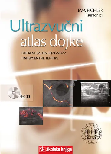 Ultrazvučni atlas dojke - Diferencijalna dijagnoza i interventne tehnike (+ cd), Pichler Eva i suradnici