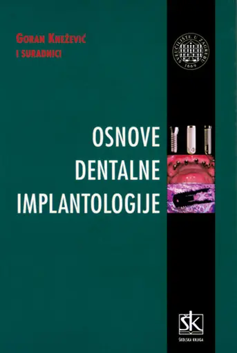 Osnove dentalne implantologije, Knežević Goran i suradnici