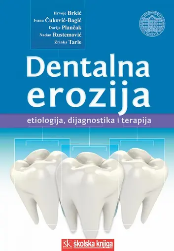 Dentalna erozija - etiologija, dijagnostika i terapija, Brkić Hrvoje, Čuković - Bagić Ivana, Plančak Darije, Rustemović Nadan, Tarle Zrinka