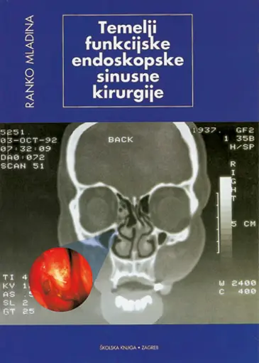 Temelji funkcijske endoskopske sinusne kirurgije, Mladina Ranko